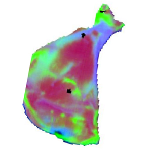 NIR camera back of bone - chemical colour image